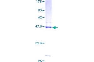 NDUFB8 Protein (AA 1-186) (GST tag)