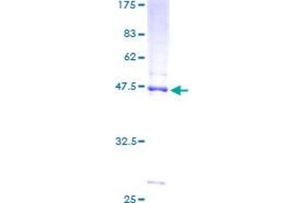 NDUFB8 Protein (AA 1-186) (GST tag)