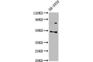Western Blot Positive WB detected in: SH-SY5Y whole cell lysate All lanes: CSNK1E antibody at 3 μg/mL Secondary Goat polyclonal to rabbit IgG at 1/50000 dilution Predicted band size: 48 kDa Observed band size: 48 kDa (CK1 epsilon antibody  (Isoform epsilon))