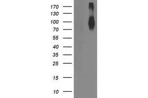 Western Blotting (WB) image for anti-Fibroblast Growth Factor Receptor 2 (FGFR2) antibody (ABIN1498250) (FGFR2 antibody)