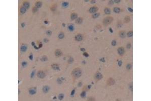Used in DAB staining on fromalin fixed paraffin- embedded Kidney tissue (FAM19A3 antibody  (AA 30-129))
