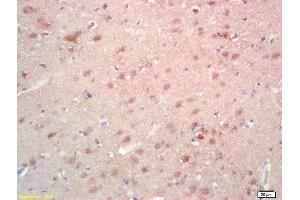 Formalin-fixed and paraffin embedded rat brain labeled with Rabbit Anti SAMD14 Polyclonal Antibody, Unconjugated (ABIN718346) at 1:200 followed by conjugation to the secondary antibody and DAB staining (SAMD14 antibody  (AA 231-330))