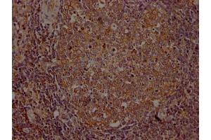 IHC image of ABIN7127585 diluted at 1:100 and staining in paraffin-embedded human lymph node tissue performed on a Leica BondTM system. (Recombinant ITK antibody)