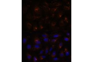 Immunofluorescence analysis of U-2 OS cells using ESYT1 antibody (ABIN7267069) at dilution of 1:100. (ESYT1 antibody  (AA 90-220))