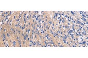 Immunohistochemistry of paraffin-embedded Human brain tissue using GALR3 Polyclonal Antibody at dilution of 1:50(x200) (GALR3 antibody)