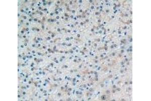 Detection of VCAM1 in Human Liver Tissue using Polyclonal Antibody to Vascular Cell Adhesion Molecule 1 (VCAM1) (VCAM1 antibody  (AA 109-318))