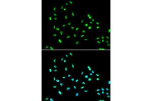 Immunofluorescence analysis of A549 cell using SMARCAD1 antibody.