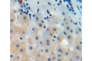 Used in DAB staining on fromalin fixed paraffin-embedded liver tissue (C9 antibody  (AA 136-512))
