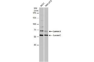 WB Image Various whole cell extracts (30 μg) were separated by 7. (Lamin A/C antibody)