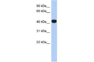 WB Suggested Anti-RASGEF1C Antibody Titration: 0. (RASGEF1C antibody  (N-Term))