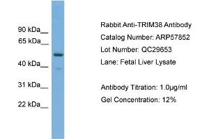 WB Suggested Anti-TRIM38  Antibody Titration: 0. (TRIM38 antibody  (Middle Region))