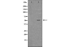 Western blot analysis of Hepg2 whole cell lysates, using CTSA Antibody. (CTSA antibody  (C-Term))