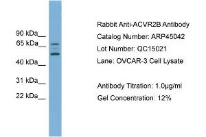 WB Suggested Anti-ACVR2B  Antibody Titration: 0. (ACVR2B antibody  (Middle Region))