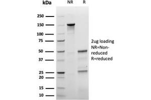 SDS-PAGE Analysis Purified p27 Recombinant Mouse Monoclonal Antibody (rKIP1/1356). (Recombinant CDKN1B antibody)