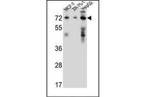 Western blot analysis of 17-beta-HSD4 / HSD17B4 Antibody (Center) in MCF-7, ZR-75-1, HepG2 cell line lysates (35ug/lane). (HSD17B4 antibody  (Middle Region))