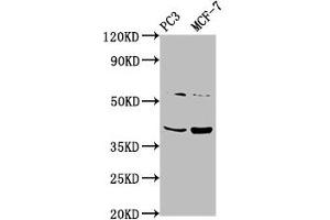 Western Blot Positive WB detected in: PC-3 whole cell lysate, MCF-7 whole cell lysate All lanes: PCGF6 antibody at 3. (PCGF6 antibody  (AA 9-70))