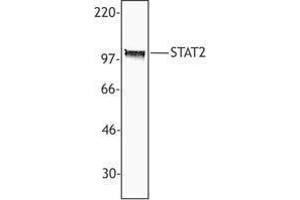 Western Blotting (WB) image for anti-Signal Transducer and Activator of Transcription 2, 113kDa (STAT2) antibody (ABIN2665501) (STAT2 antibody)