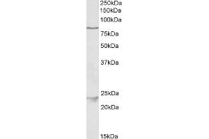ABIN1590112 (1µg/ml) staining of HeLa lysate (35µg protein in RIPA buffer). (TBK1 antibody  (AA 514-527))