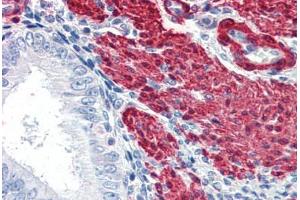 Human Uterus (formalin-fixed, paraffin-embedded) stained with TAGLN antibody ABIN337285 at 5 ug/ml followed by biotinylated anti-goat IgG secondary antibody ABIN481715, alkaline phosphatase-streptavidin and chromogen. (Transgelin antibody  (AA 190-201))