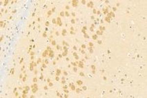 Immunohistochemistry analysis of paraffin-embedded mouse substantia nigra using SLK (ABIN7075729) at dilution of 1: 500