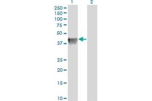 Western Blot analysis of BGN expression in transfected 293T cell line by BGN monoclonal antibody (M01), clone 4E1-1G7. (Biglycan antibody  (AA 1-368))