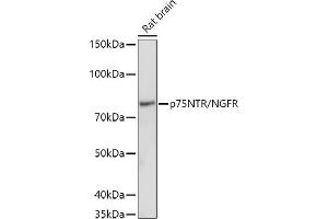 Western blot analysis of extracts of Rat brain, using (ABIN6127593, ABIN6144613, ABIN6144615 and ABIN6215090) at 1:1000 dilution. (NGFR antibody  (AA 273-427))