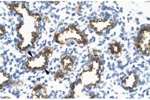 Human Lung; RFP2 antibody - middle region in Human Lung cells using Immunohistochemistry (TRIM13 antibody  (Middle Region))