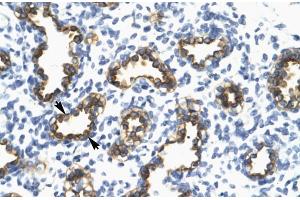 Human Lung; RFP2 antibody - middle region in Human Lung cells using Immunohistochemistry (TRIM13 antibody  (Middle Region))