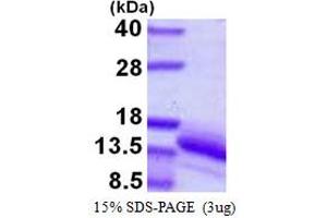 SDS-PAGE (SDS) image for Vesicular, Overexpressed in Cancer, Prosurvival Protein 1 (VOPP1) (AA 82-172) protein (His tag) (ABIN7279458)
