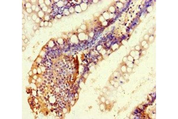 RTEL1 antibody  (AA 975-1219)