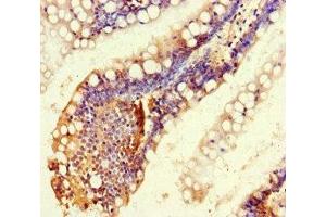 Immunohistochemistry of paraffin-embedded human small intestine tissue using ABIN7167648 at dilution of 1:100 (RTEL1 antibody  (AA 975-1219))
