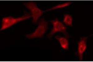 OR56B4 antibody  (C-Term)