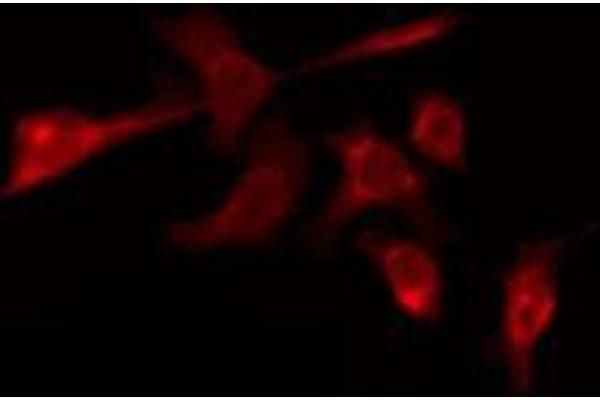 OR56B4 antibody  (C-Term)