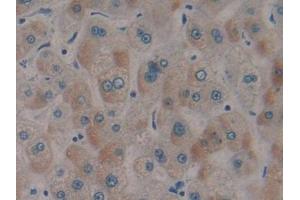 DAB staining on IHC-P; Samples: Human Liver Tissue (SRF antibody  (AA 231-474))
