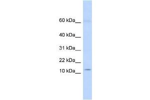 WB Suggested Anti-KRTAP8-1 Antibody Titration:  0.