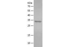 Western Blotting (WB) image for Insulin-Like Growth Factor 1 (IGF1) (AA 49-118) protein (His-IF2DI Tag) (ABIN7123449)