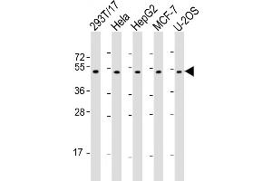 All lanes : Anti-PLAGL1 Antibody (N-Term) at 1:2000 dilution Lane 1: 293T/17 whole cell lysate Lane 2: Hela whole cell lysate Lane 3: HepG2 whole cell lysate Lane 4: MCF-7 whole cell lysate Lane 5: U-2OS whole cell lysate Lysates/proteins at 20 μg per lane. (PLAGL1 antibody  (AA 112-146))