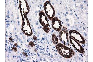 Immunohistochemical staining of paraffin-embedded Human Kidney tissue using anti-ATP6V1B1 mouse monoclonal antibody. (ATP6V1B1 antibody)