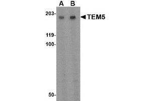 Image no. 1 for anti-G Protein-Coupled Receptor 124 (GPR124) (Internal Region) antibody (ABIN1493615) (GPR124 antibody  (Internal Region))
