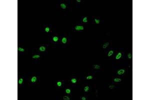 Immunofluorescent analysis of Hela cells treated with NaB using ABIN7139166 at dilution of 1:100 and Alexa Fluor 488-congugated AffiniPure Goat Anti-Rabbit IgG(H+L) (HIST1H2BB antibody  (acLys16))