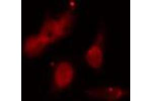 ABIN6273522 staining HeLa cells by IF/ICC. (PMS2 antibody  (C-Term))