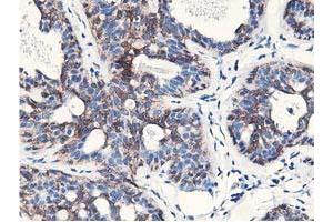 Immunohistochemical staining of paraffin-embedded Human breast tissue using anti-NUDT18 mouse monoclonal antibody.