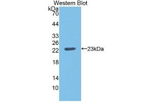 Figure. (CD40 antibody  (AA 24-193))