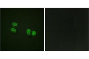 Immunofluorescence analysis of HeLa cells, using DDX5/DEAD-box Protein 5 (Phospho-Tyr593) Antibody. (DDX5 antibody  (pTyr593))