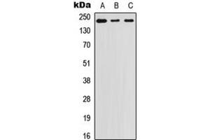 Western blot analysis of Laminin beta 1 expression in A431 (A), SW480 (B), PC3 (C) whole cell lysates.