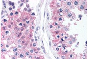 Human Testis (formalin-fixed, paraffin-embedded) stained with MAPK1 antibody ABIN218336 at 1:50 followed by biotinylated goat anti-rabbit IgG secondary antibody ABIN481713, alkaline phosphatase-streptavidin and chromogen. (ERK2 antibody  (C-Term))