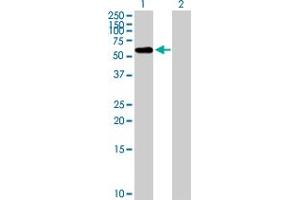 Western Blot analysis of FBXO3 expression in transfected 293T cell line by FBXO3 MaxPab polyclonal antibody. (F-Box Protein 3 antibody  (AA 1-471))