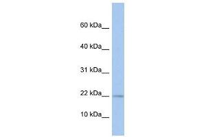 MPV17L antibody used at 1 ug/ml to detect target protein. (MPV17L antibody  (N-Term))
