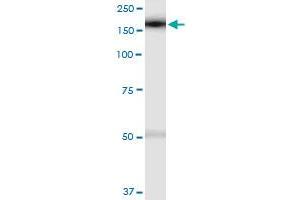 Immunoprecipitation (IP) image for anti-SWI/SNF-Related, Matrix-Associated Actin-Dependent Regulator of Chromatin, Subfamily A, Containing DEAD/H Box 1 (SMARCAD1) (AA 1-1028) antibody (ABIN528005)