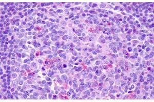 Anti-CCR7 antibody IHC staining of human tonsil. (CCR7 antibody  (C-Term))